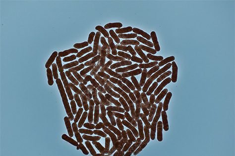 Bacteria management.png